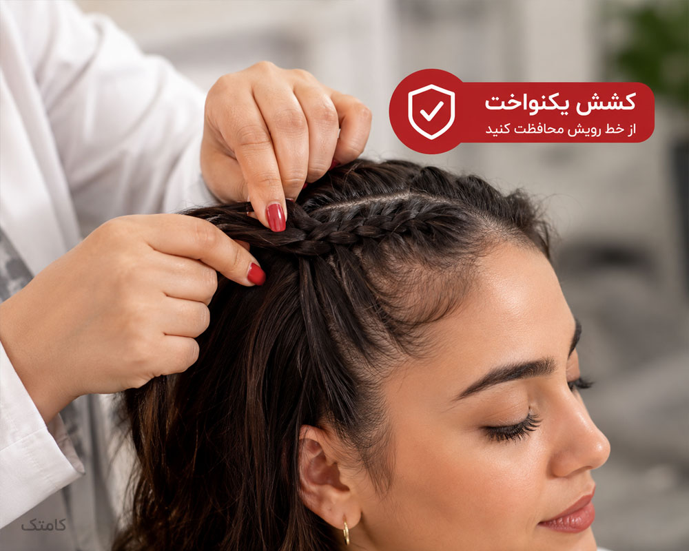 کنترل کشش بافت