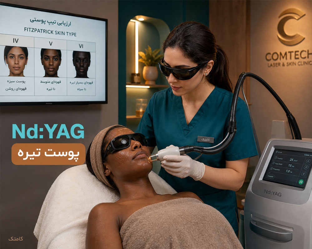 آموزش لیزر Nd:YAG برای ارزیابی ایمن پوست‌های دارای پیگمنت بیشتر